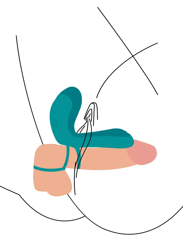 Couples Vibrator Ring - Vibruojantis gaidžio žiedas 2